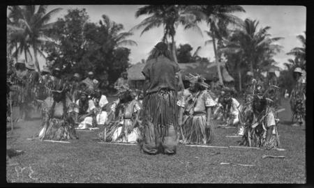Dance on Aitutaki, lead dancer&#39;s legs swollen from elephantiasis
