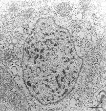 CIL:36260, Vorticella convallaria, cell by organism, eukaryotic cell ...