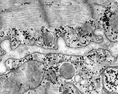 CIL:37210, Rattus, cardiac muscle cell | Library Digital Collections ...