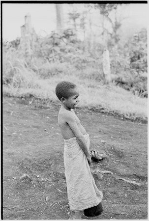 Yeria, Wanuma Census Division: child with skin fungus
