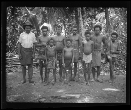 Group portrait, individuals with yaws, hookworm, and elephantiasis in Makira